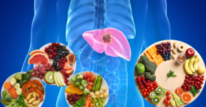 diet plan for fatty liver