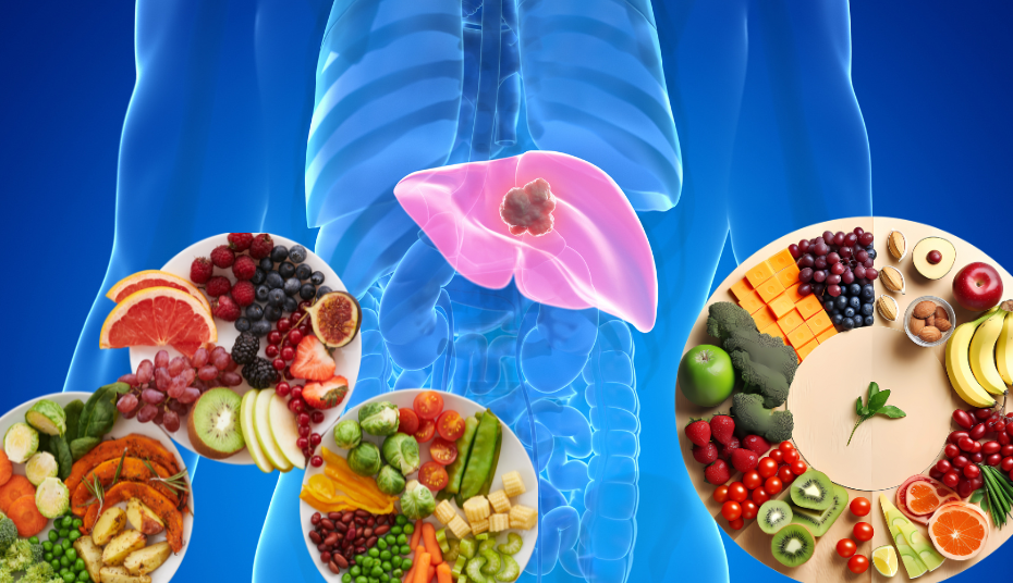 diet plan for fatty liver