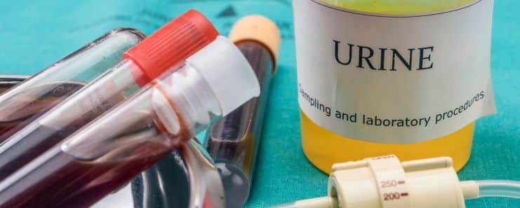  Blood In Urine